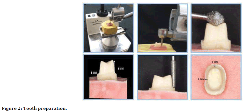 medical-dental-science-tooth-preparation