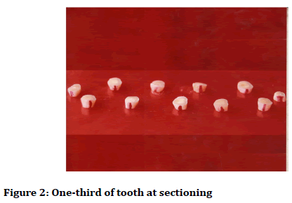 medical-dental-science-tooth-sectioning