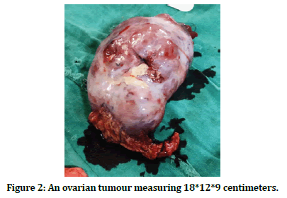 medical-dental-science-tumour-measuring