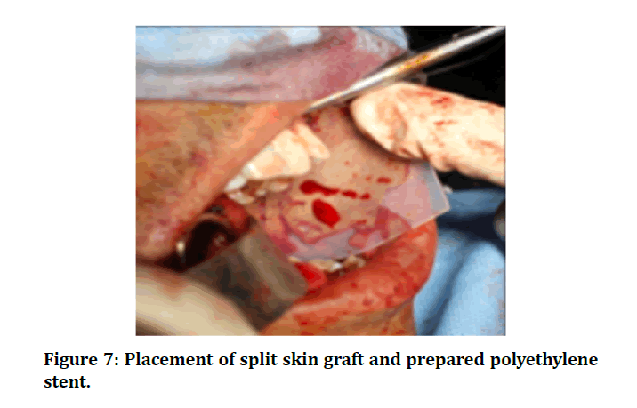 medical-dental-split-skin