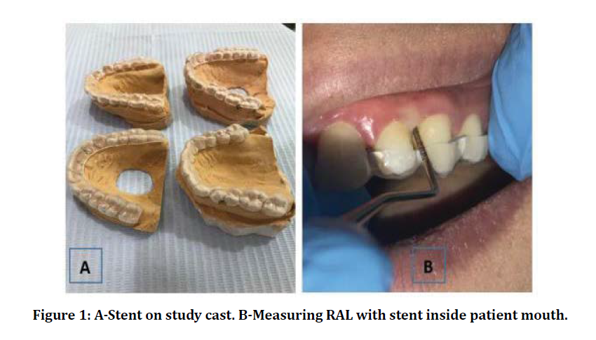medical-dental-stent-inside