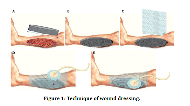 medical-dental-wound-dressing