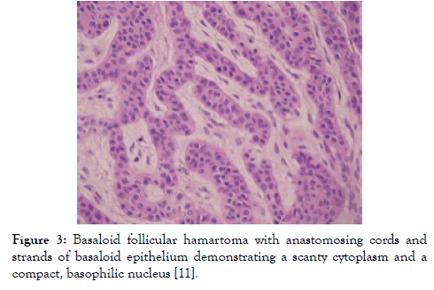 medical-diagnostic-methods-anastomosing