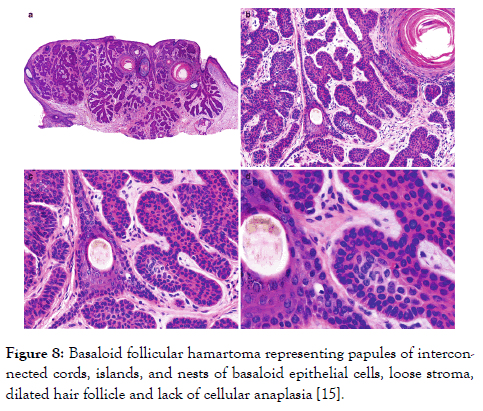 medical-diagnostic-methods-epithelial