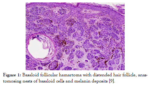 medical-diagnostic-methods-follicular