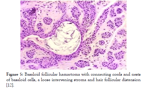 medical-diagnostic-methods-stroma