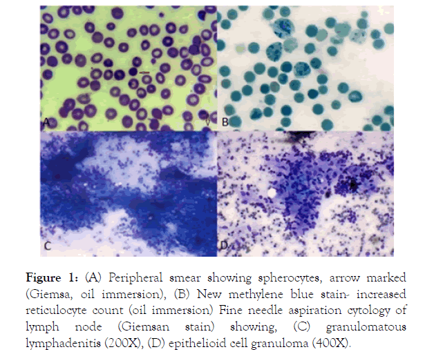 medical-surgical-pathology-spherocytes