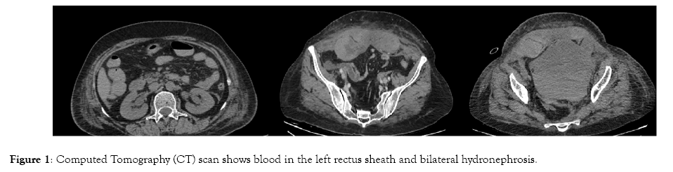 medical-surgical-urology-bilateral