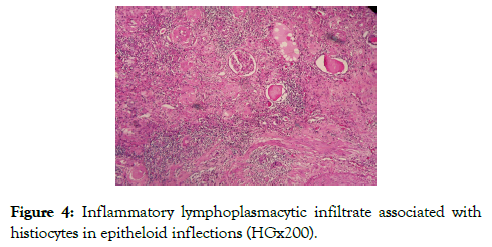 medical-surgical-urology-infiltrate