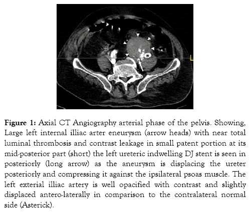 medical-surgical-urology-mid-posterior