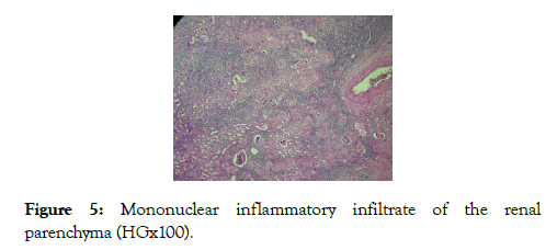 medical-surgical-urology-parenchyma