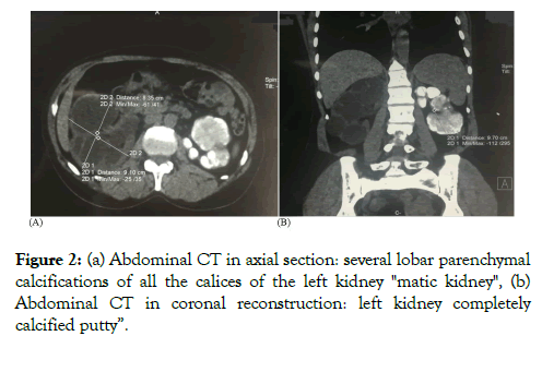 medical-surgical-urology-parenchymal