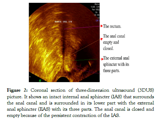 medical-surgical-urology-picture