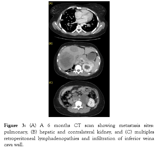 medical-surgical-urology-pulmonary