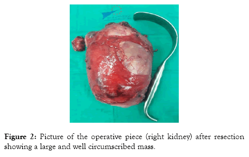 medical-surgical-urology-resection