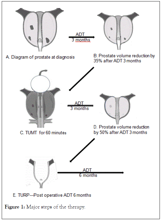 medical-surgical-urology-steps-therapy