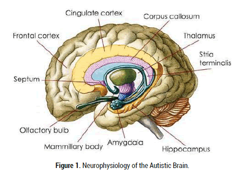 neurology-neurophysiology-autistic-brain