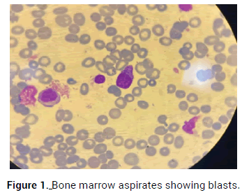 oncology-cancer-case-reports-bone-marrow