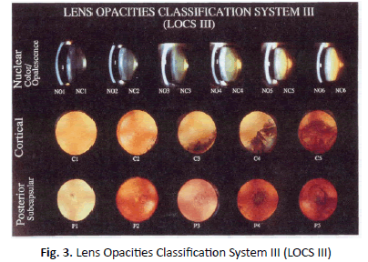 oncologyradiotherapy-Opacities