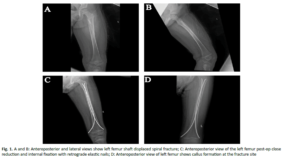 oncologyradiotherapy-anteroposterior