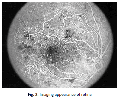 oncologyradiotherapy-appearance