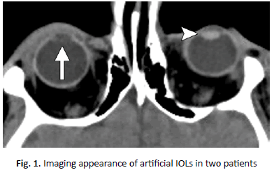 oncologyradiotherapy-artificial