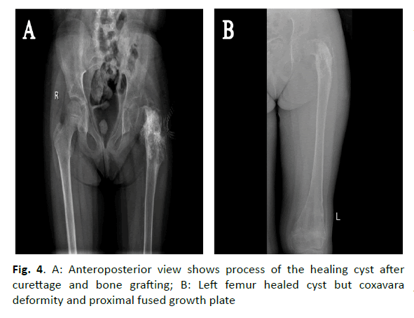 oncologyradiotherapy-grafting