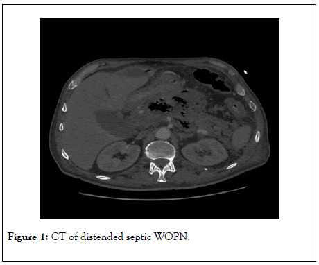 pancreatic-disorders-therapy-distended