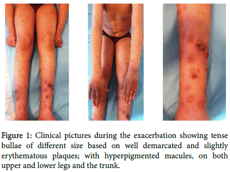 pediatrics-therapeutics-Clinical-pictures