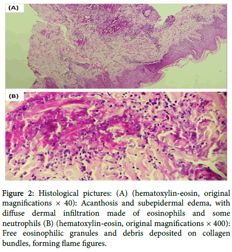 pediatrics-therapeutics-hematoxylin-eosin