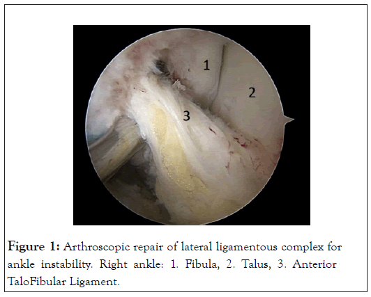 physical-medicine-arthroscopic