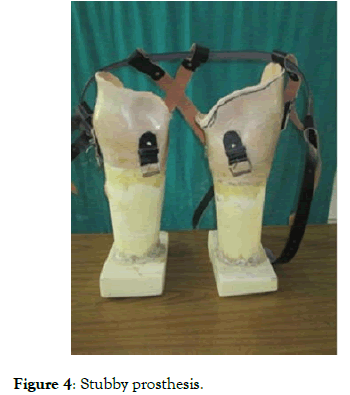 physical-medicine-prosthesis