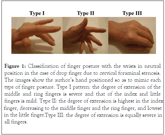 physical-medicine-rehabilitation-wrists