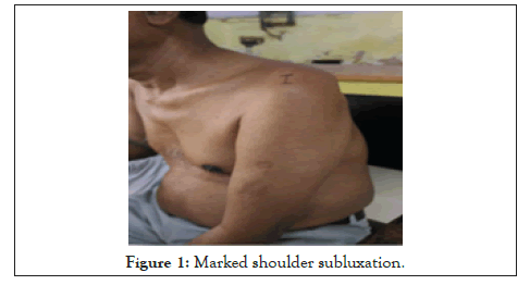 physical-medicine-shoulder