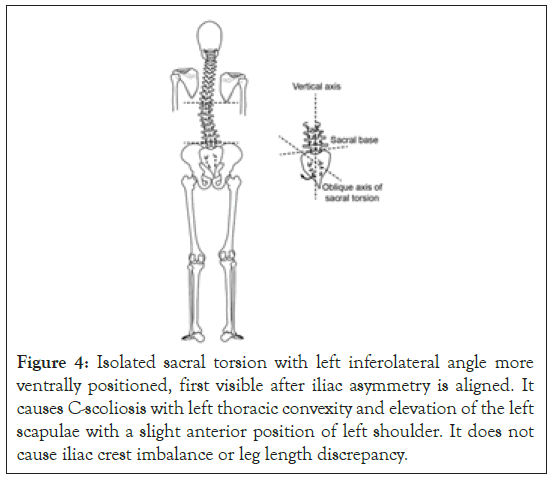 physical-medicine-torsion