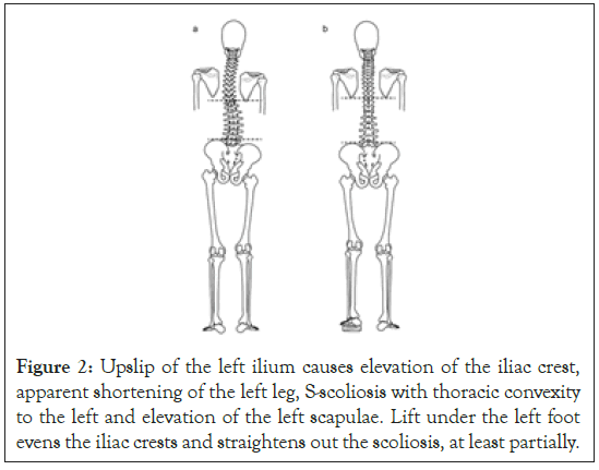 physical-medicine-upslip