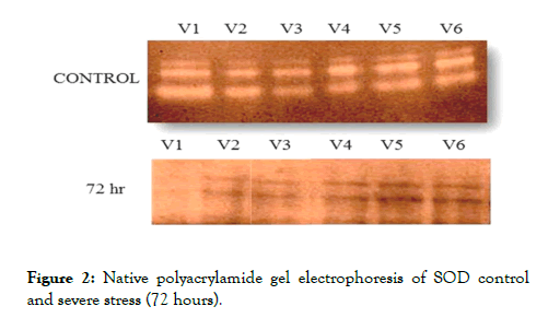 plant-biochemistry-physiology-Native-polyacrylamide