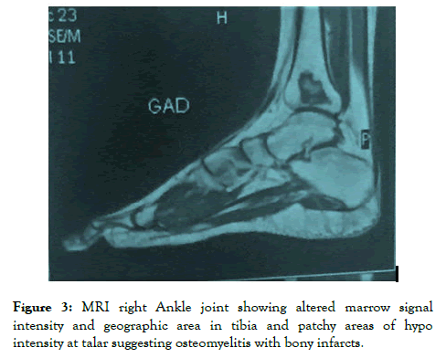 rheumatology-Ankle-joint