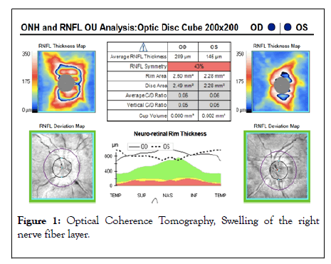 rheumatology-current-research-optical-coherence