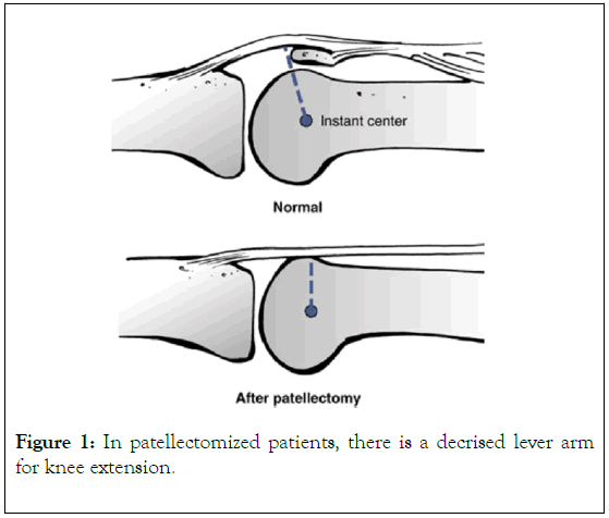 rheumatology-patients