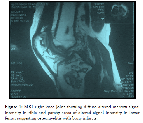 rheumatology-right-knee