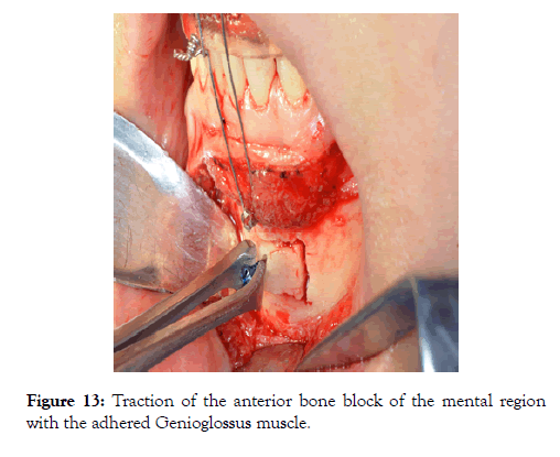 sleep-disorders-therapy-anterior