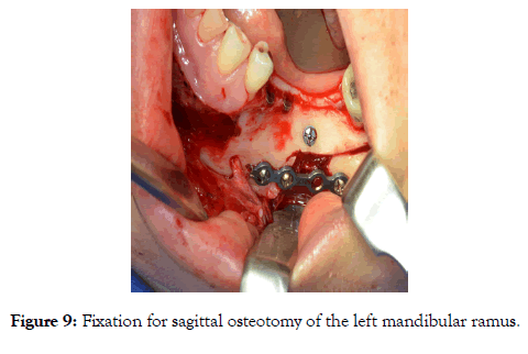 sleep-disorders-therapy-sagittal