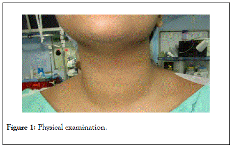 thyroid-disorders-therapy-Physical