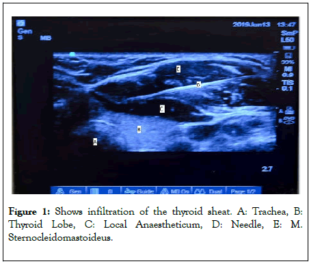 thyroid-disorders-therapy-thyroid