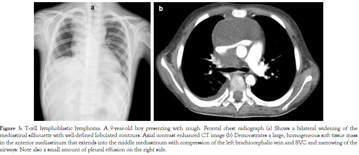 translational-medicine-Frontal-chest