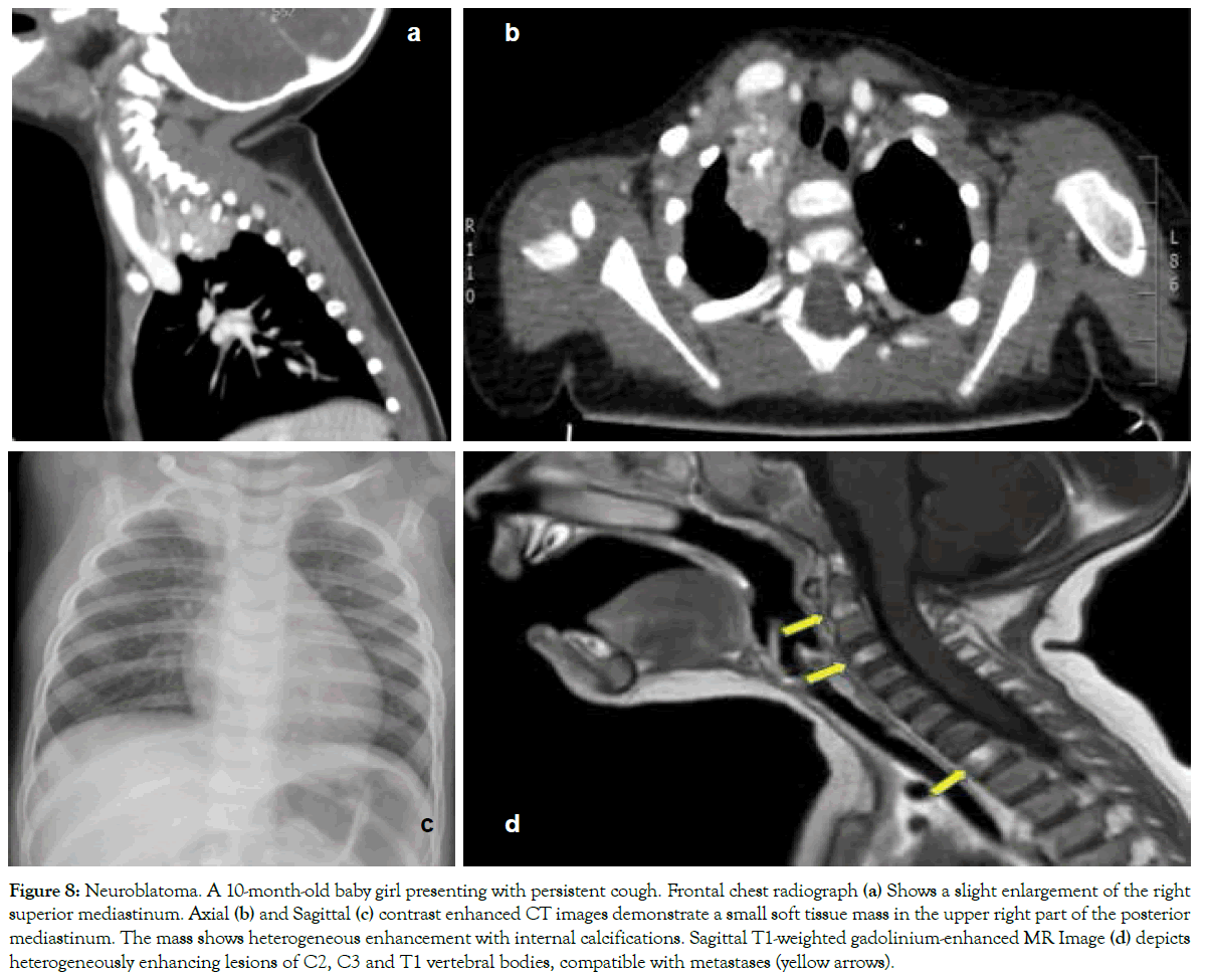 translational-medicine-vertebral-bodies