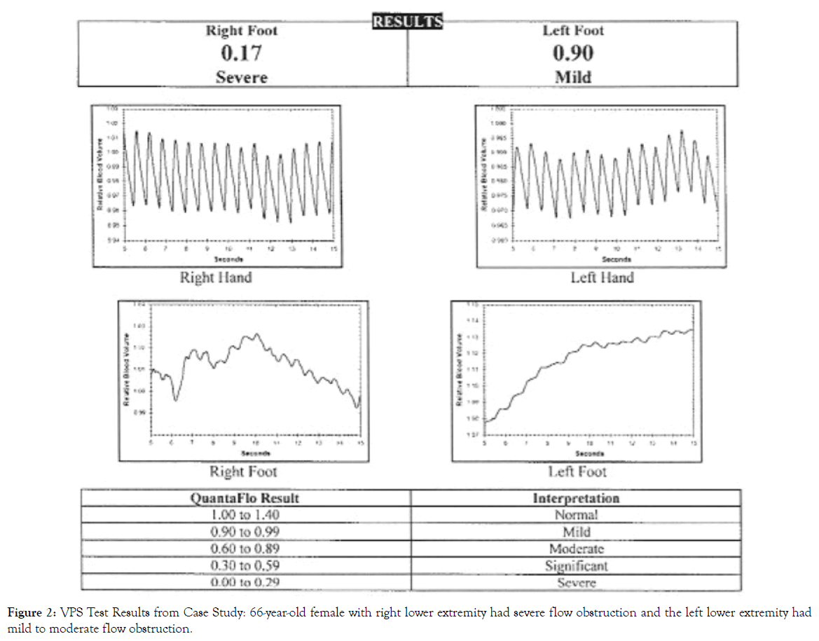 women-central-moderate-flow-obstruction