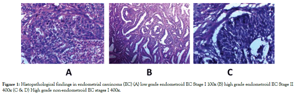 womens-health-care-Histopathological