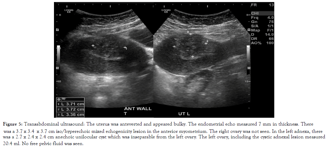 womens-health-care-transabdominal-ultrasound